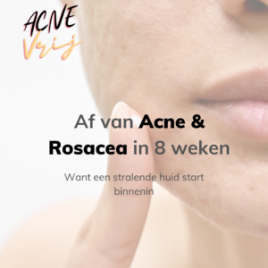 Acne vrij in 8 weken – Traject
